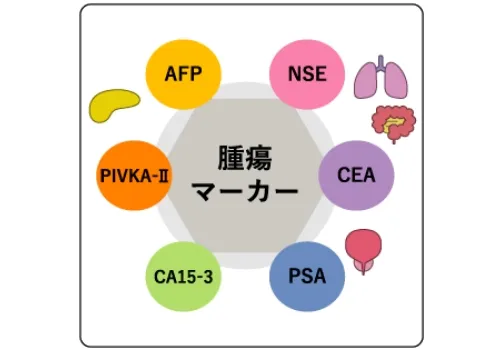 腫瘍マーカー検査（年1回） 